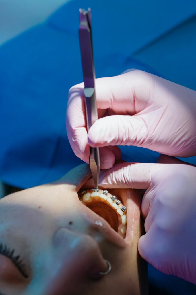 pexels-photo-6529056-6529056 Treating of a Teeth with Braces